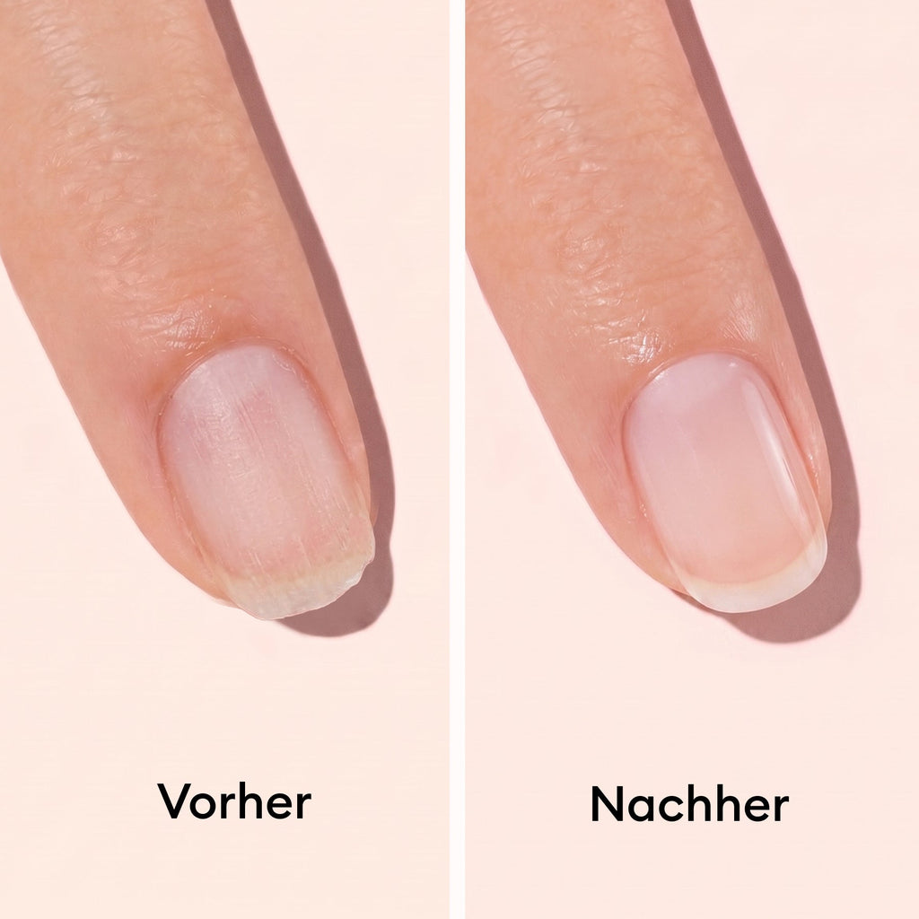 Nail hardener