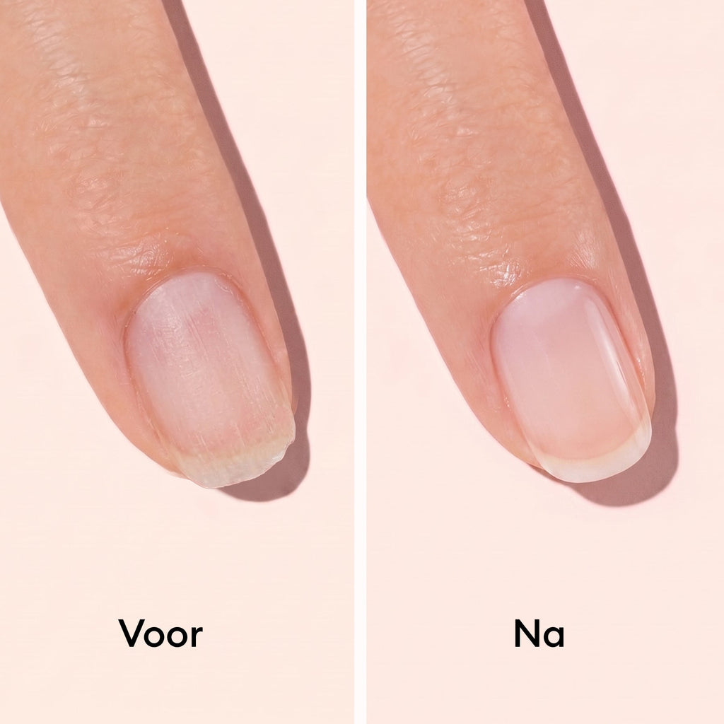 Nail hardener