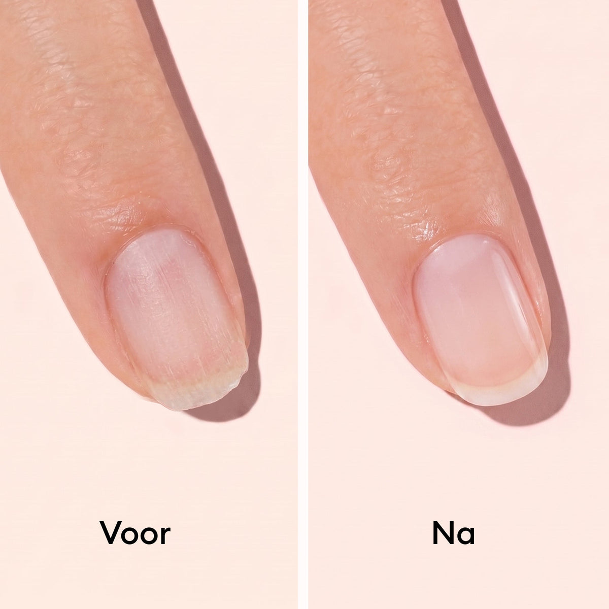 Nail hardener